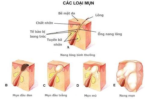 kem-tri-mun-trung-ca-hieu-qua-2